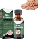 Nail Fungus Treatment Serum for Fingernails and Toenails